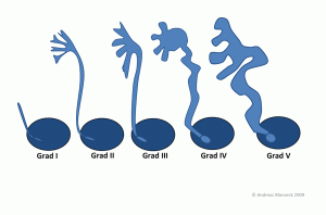 vesikorenaler-reflux-schweregrade-61