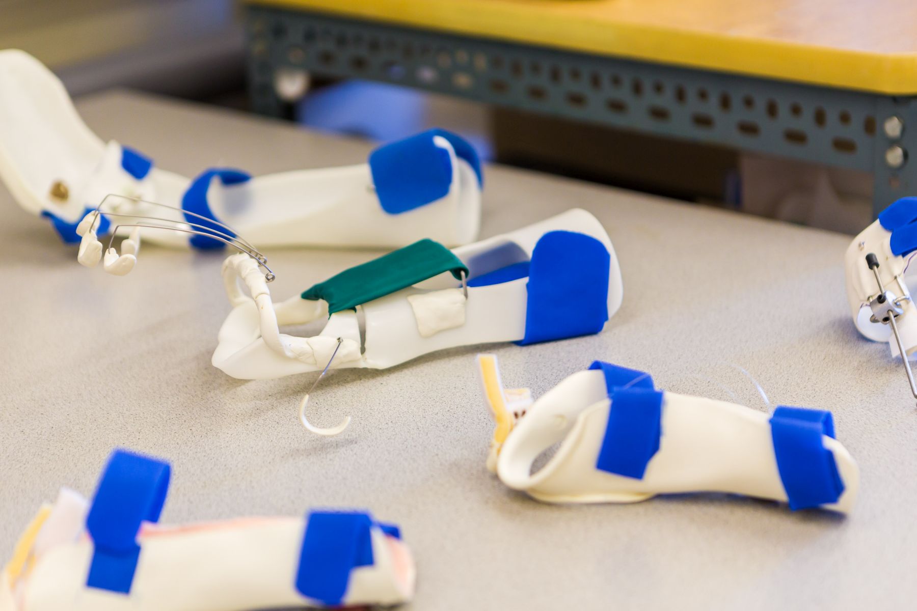 In der Ergotherapie hergestellte, individuell angepasste, statische und dynamische Schienen